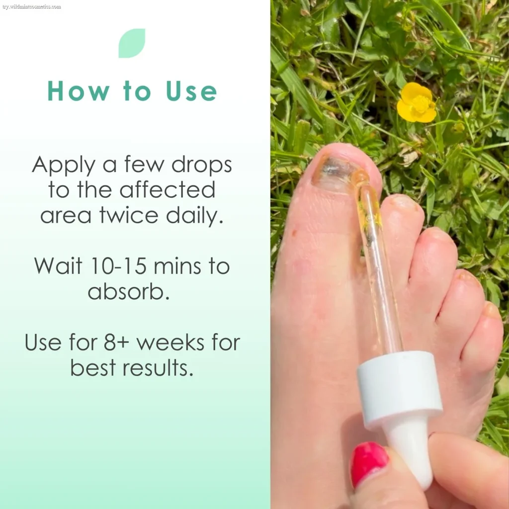 Fungal Freedom nail oil